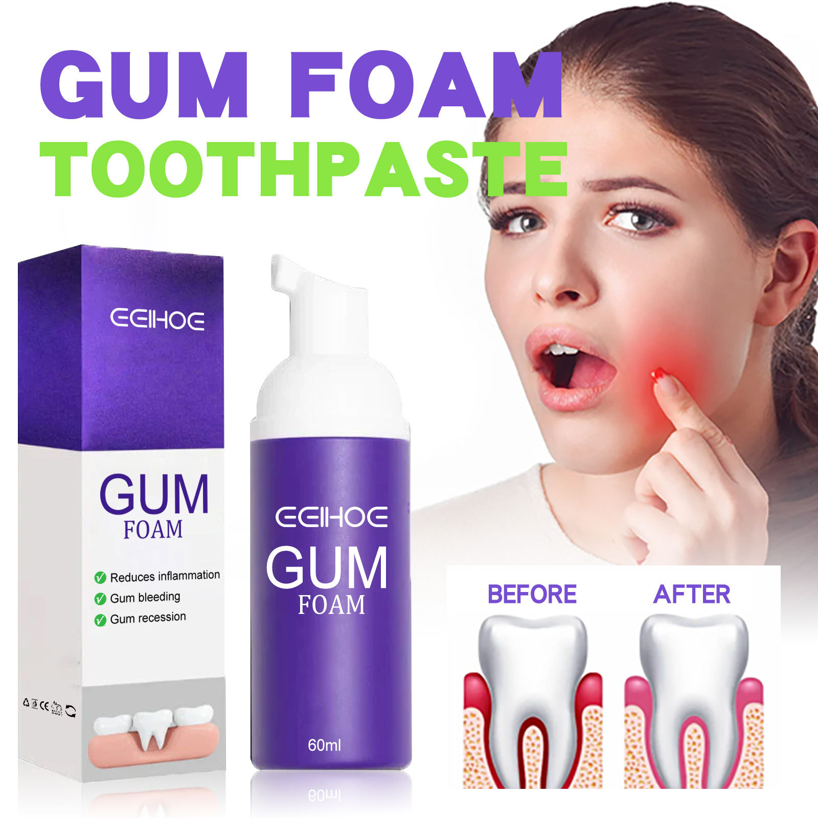 Teeth Whitening Best - 60 ml Diş Beyazlatma Köpüğü V34