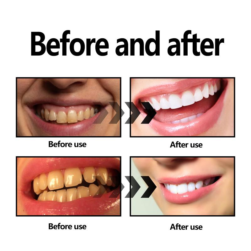 Diş Beyazlatma Tozu Kömür / Ka - Teeth Whitening With Baking Soda incelemesi ve fiyatı
