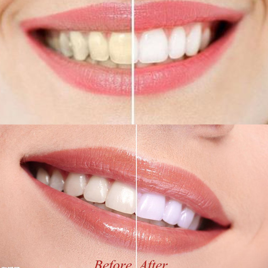 Bambu kömür diş diş diş hekimi - Teeth Whitening Zimba incelemesi ve fiyatı