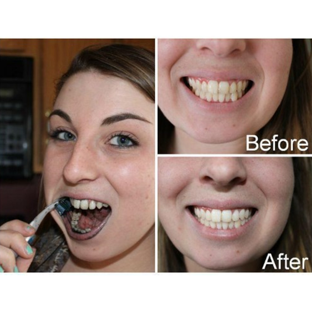 Bambu kömür diş diş diş hekimi - Teeth Whitening Zimba incelemesi ve fiyatı