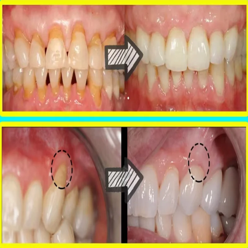 Hızla Onarım Sakız Serumu Raha - Teeth Whitening With Baking Soda incelemesi ve fiyatı