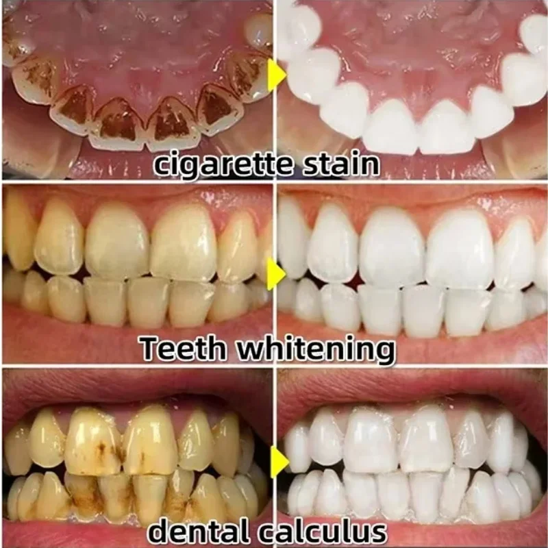 Hızla Onarım Sakız Serumu Raha - Teeth Whitening With Baking Soda incelemesi ve fiyatı