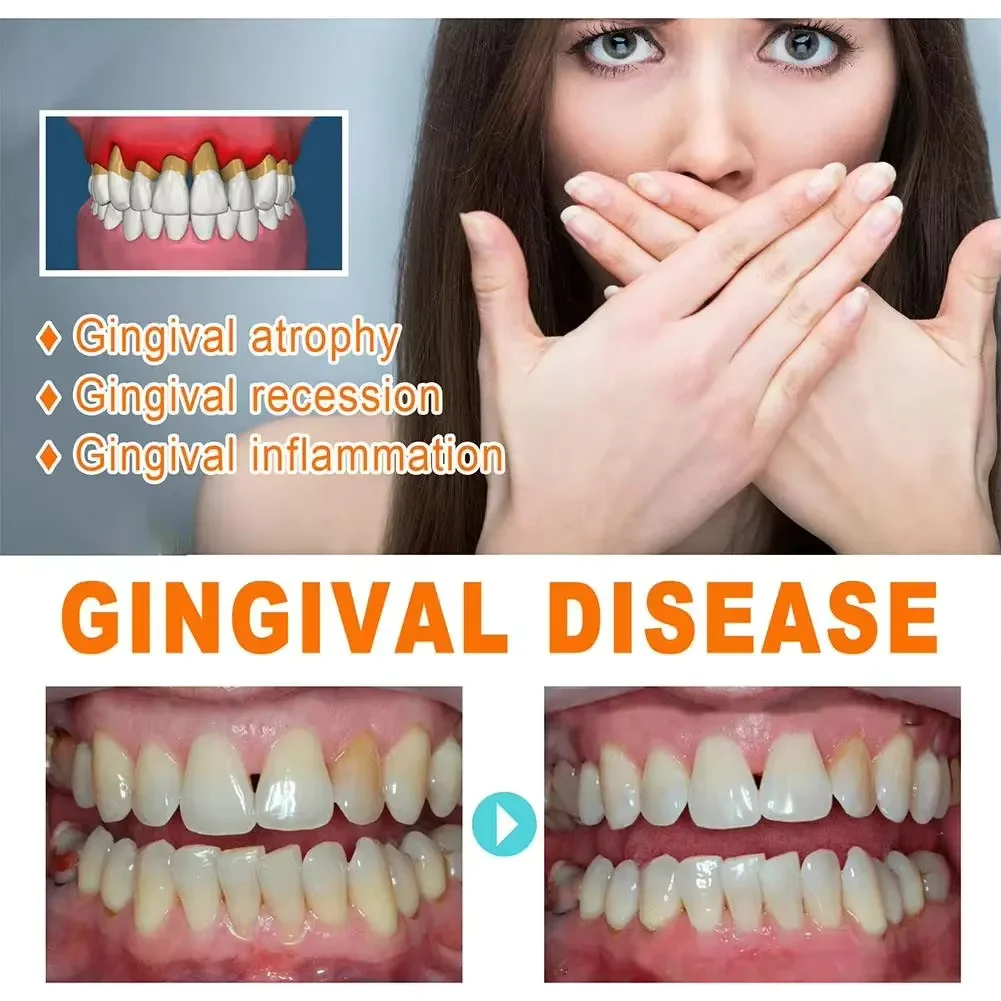 Hızla Onarım Sakız Serumu Raha - Teeth Whitening With Baking Soda incelemesi ve fiyatı