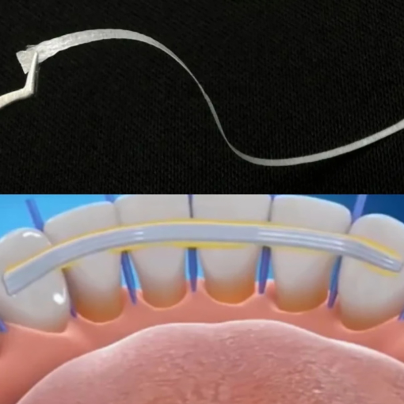 1/5 adet cam ateli gevşek diş  - Teeth Whitening Strips Crest incelemesi ve fiyatı