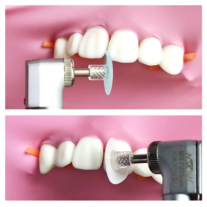 40 adet diş parlatma diski kom - Teeth Whitening Uk incelemesi ve fiyatı