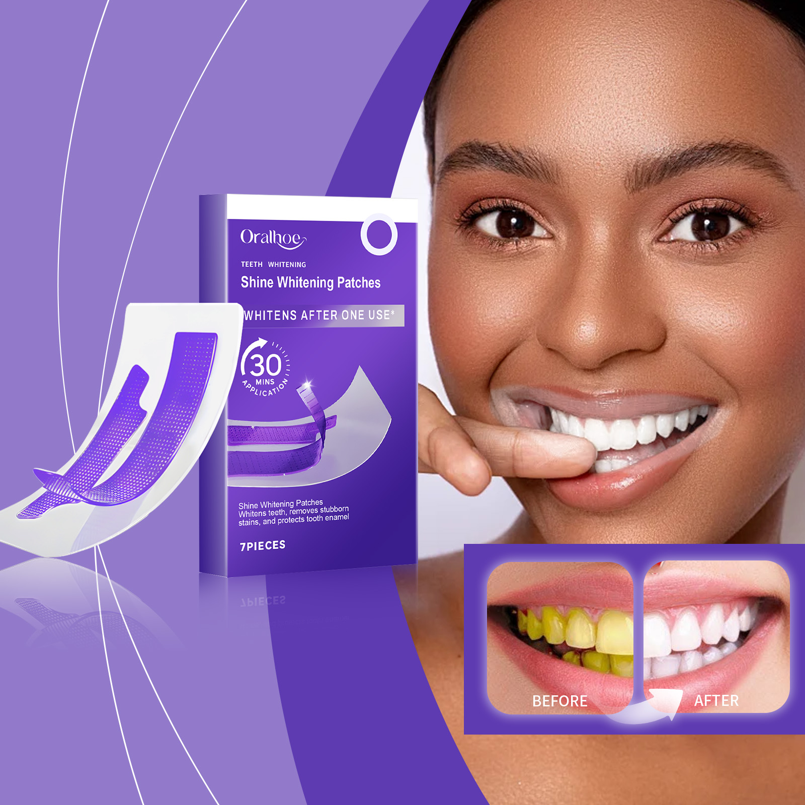 Mor Diş Beyazlatma Şeritleri – - Teeth Whitening Strips Crest incelemesi ve fiyatı
