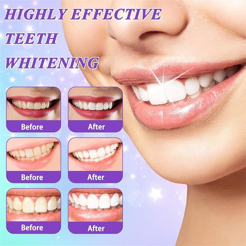 9D Mor Diş Beyazlatıcı Diş Mac - Teeth Whitening Best incelemesi ve fiyatı