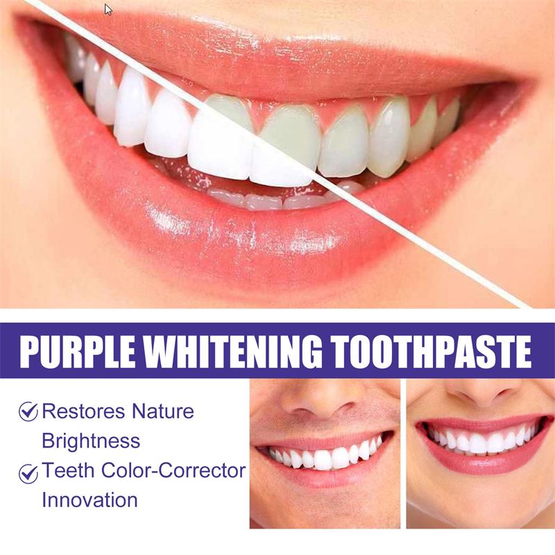 9D Mor Diş Beyazlatıcı Diş Mac - Teeth Whitening Best incelemesi ve fiyatı