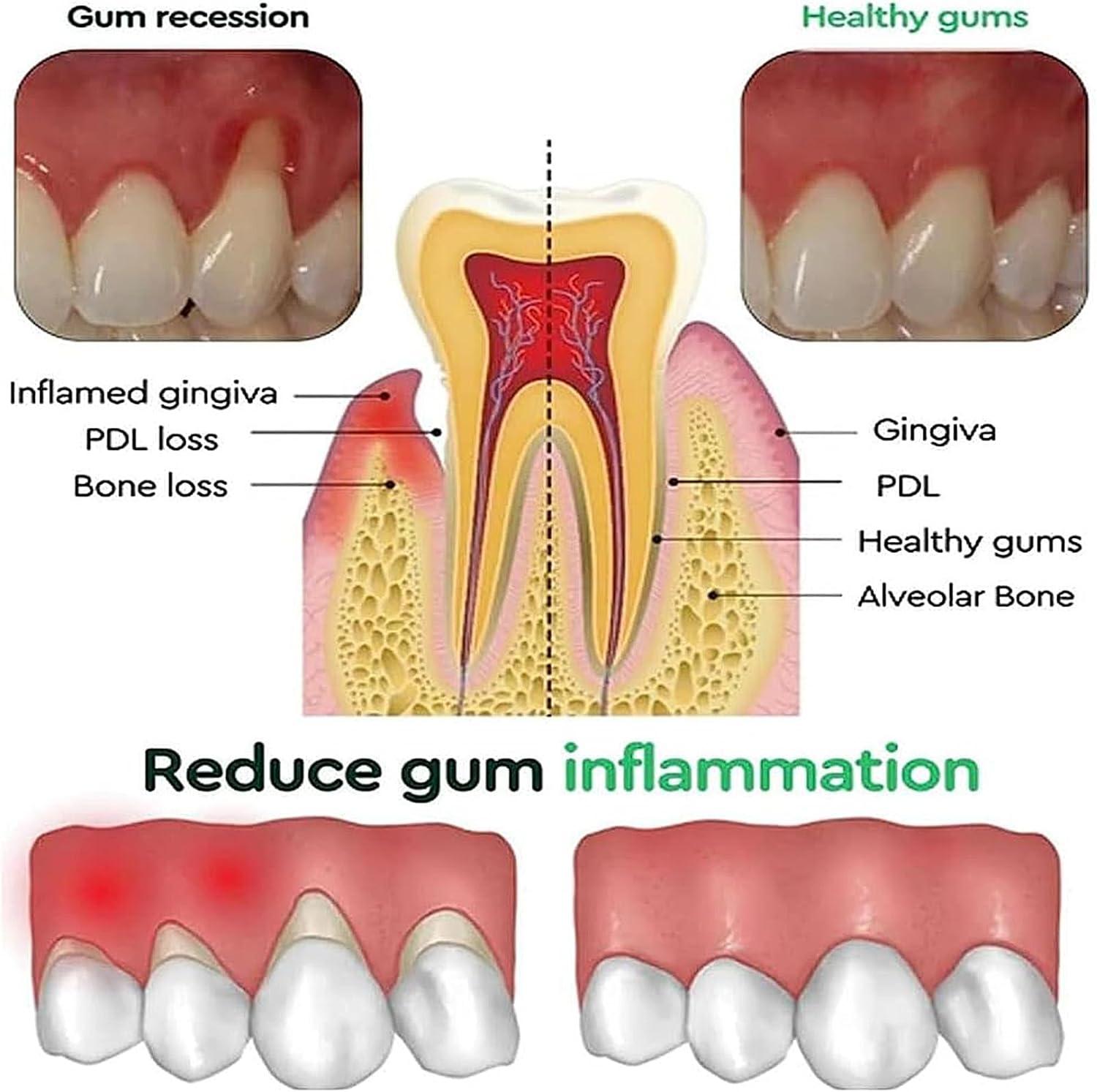Hızlı Onarım Diş Eti Jeli Etki - Teeth Whitening Foam incelemesi ve fiyatı