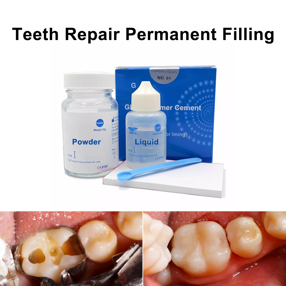 Kalıcı diş doldurma tamir kiti - Teeth Whitening At Home Kit incelemesi ve fiyatı