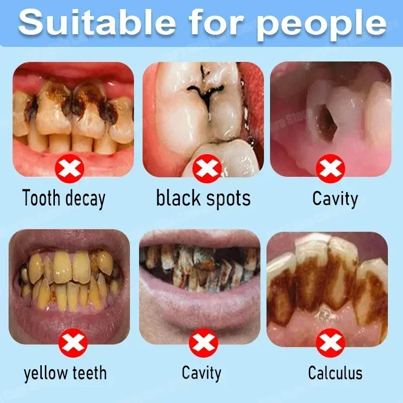Çürük Önleyici Diş Macunu Çürü - Teeth Whitening Best incelemesi ve fiyatı