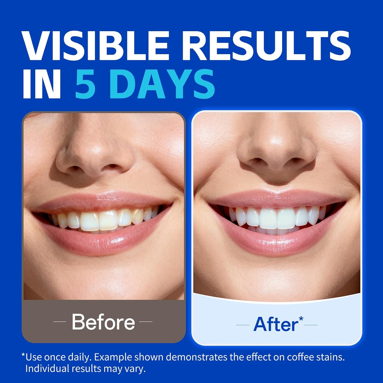 Daha Beyaz Görünümlü Bir Gülüm - Teeth Whitening Strips Crest incelemesi ve fiyatı