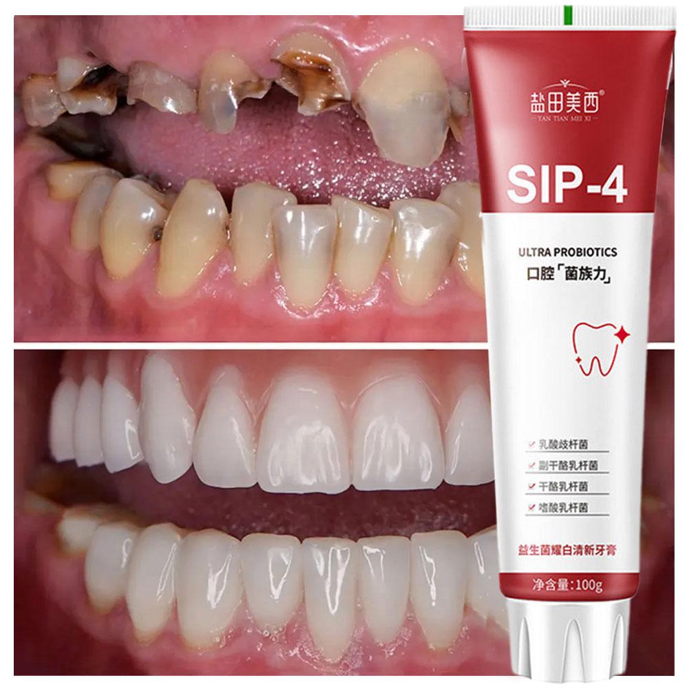 100g Sip-4 Probiyotik Beyazlat - Teeth Whitening Best incelemesi ve fiyatı
