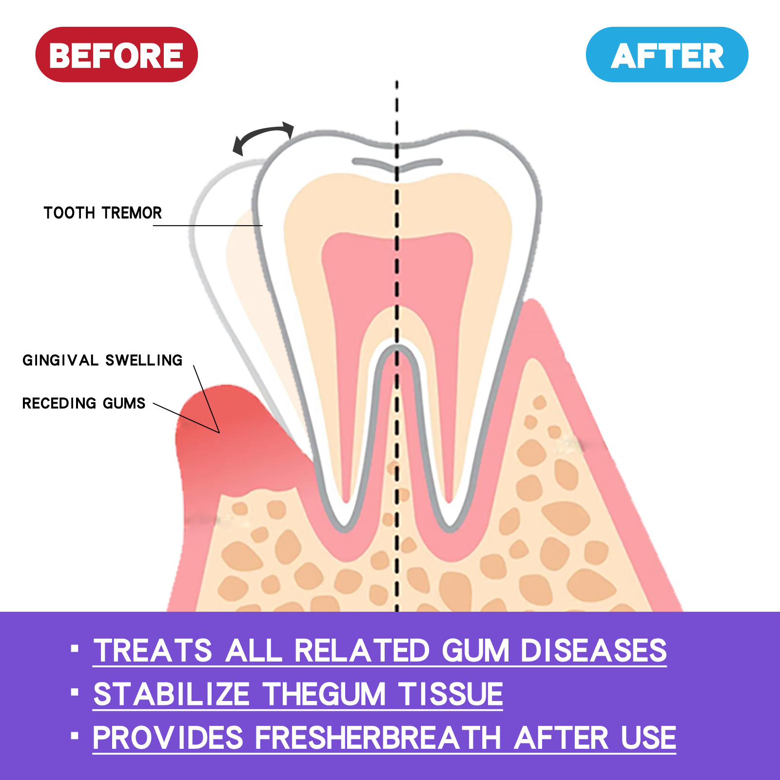 60 ml Diş Beyazlatma Köpüğü V3 - Teeth Whitening Best incelemesi ve fiyatı