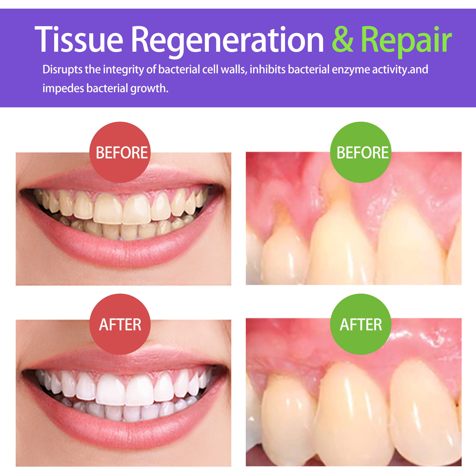 60 ml Diş Beyazlatma Köpüğü V3 - Teeth Whitening Best incelemesi ve fiyatı