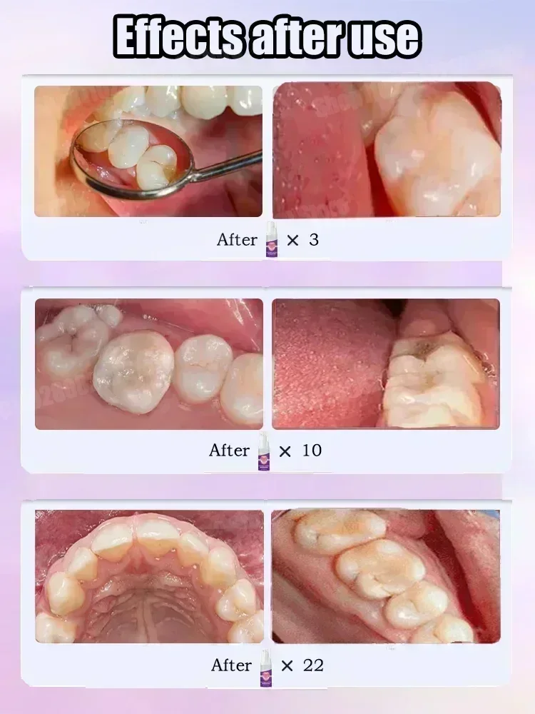 Diş Temizleme Diş Macunu Diş L - Teeth Whitening Best incelemesi ve fiyatı
