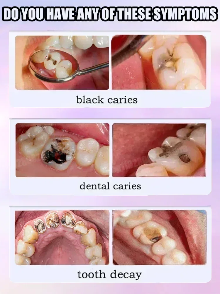 Diş Temizleme Diş Macunu Diş L - Teeth Whitening Best incelemesi ve fiyatı