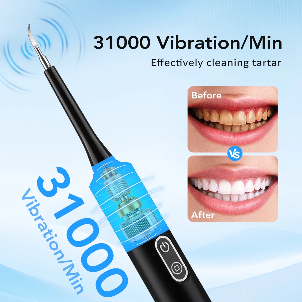 Elektrikli Sonik Titreşimli Di - Teeth Whitening Uk incelemesi ve fiyatı